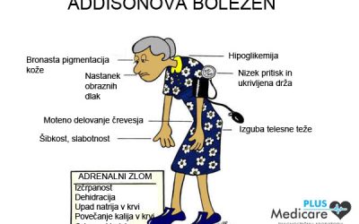 Addisonova bolezen – težave nadledvične žleze