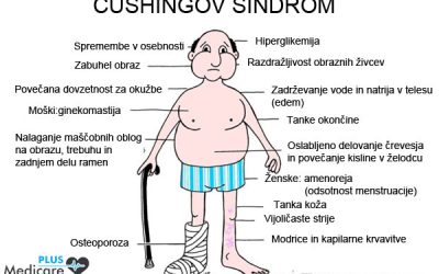Cushingov sindrom – visok kortizol